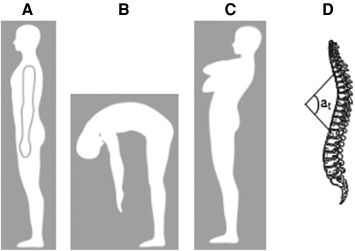 How to Perform a Pilates arc routine to treat kyphotic spines