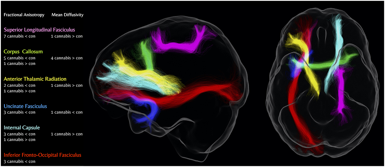 Frontiers  Age-Related Variations in Regional White Matter Volumetry and  Microstructure During the Post-adolescence Period: A Cross-Sectional Study  of a Cohort of 1,713 University Students