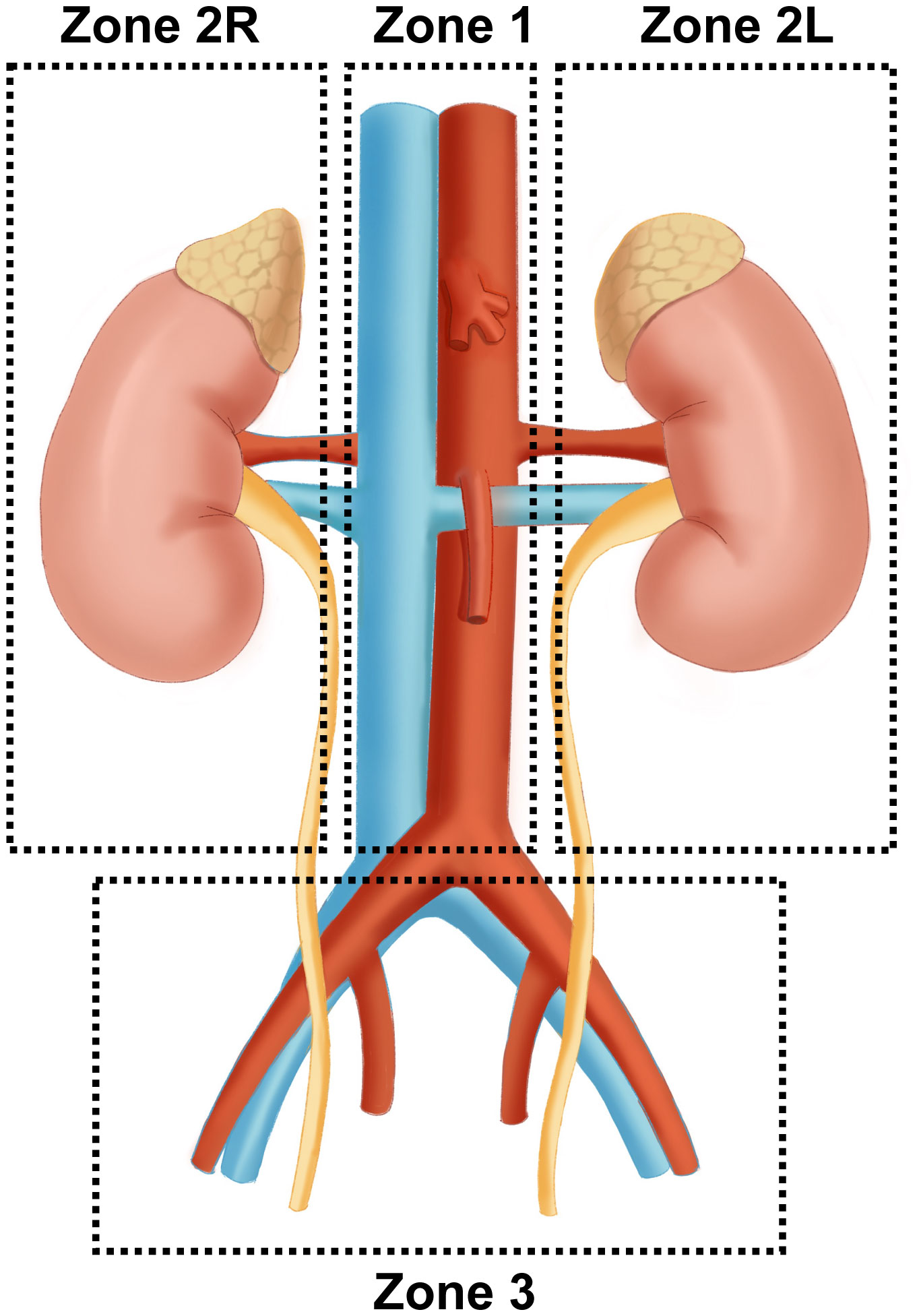 View of Surgical and Pharmacological Management of Functioning  Pheochromocytoma and Paraganglioma