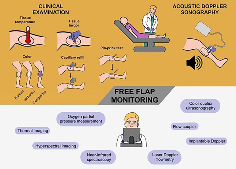 Frontiers  Postoperative free flap monitoring in reconstructive  surgery—man or machine?