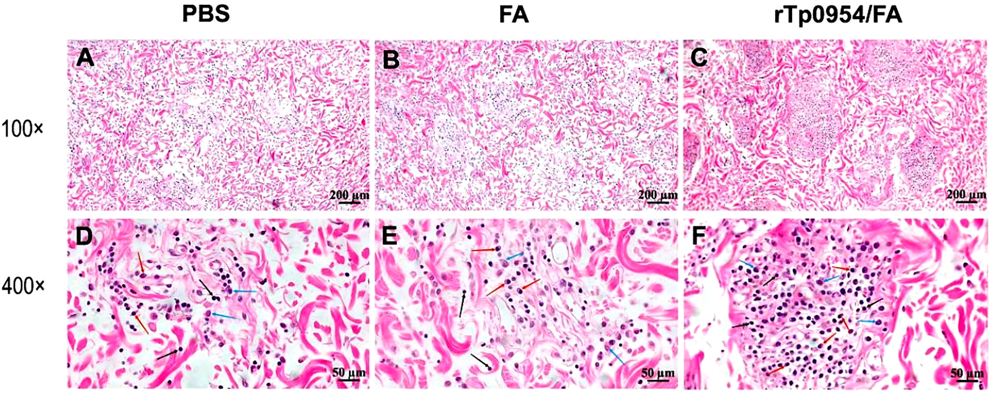 Frontiers  Identification and Functional Assessment of the First Placental  Adhesin of Treponema pallidum That May Play Critical Role in Congenital  Syphilis