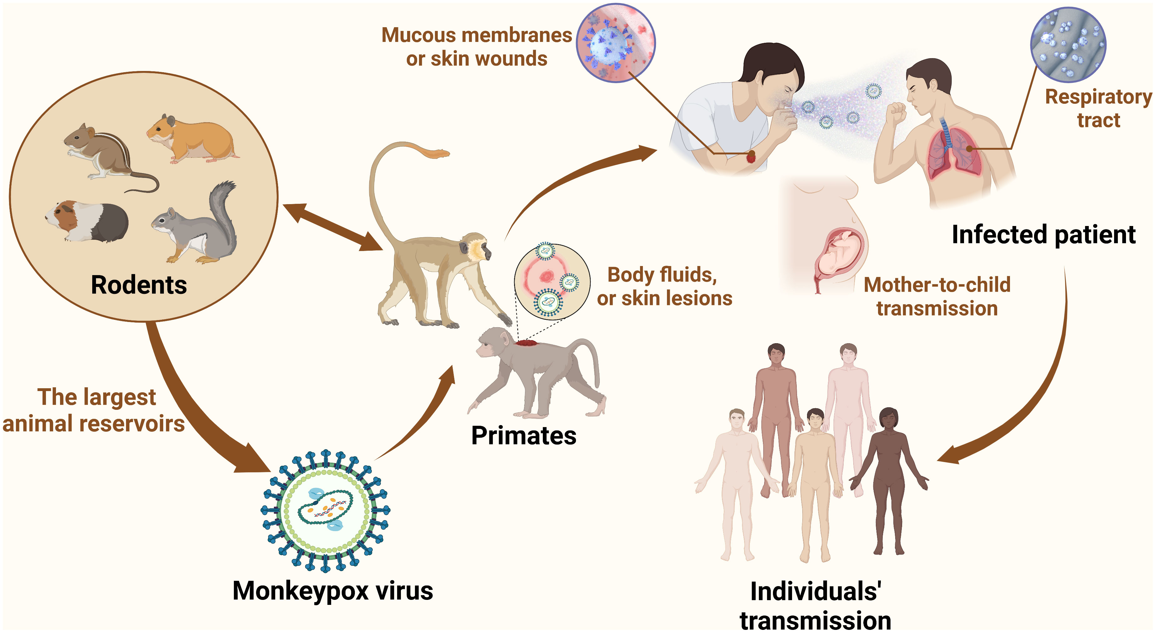 Novel severe oculocutaneous manifestations of human monkeypox virus  infection and their historical analogues - The Lancet Infectious Diseases