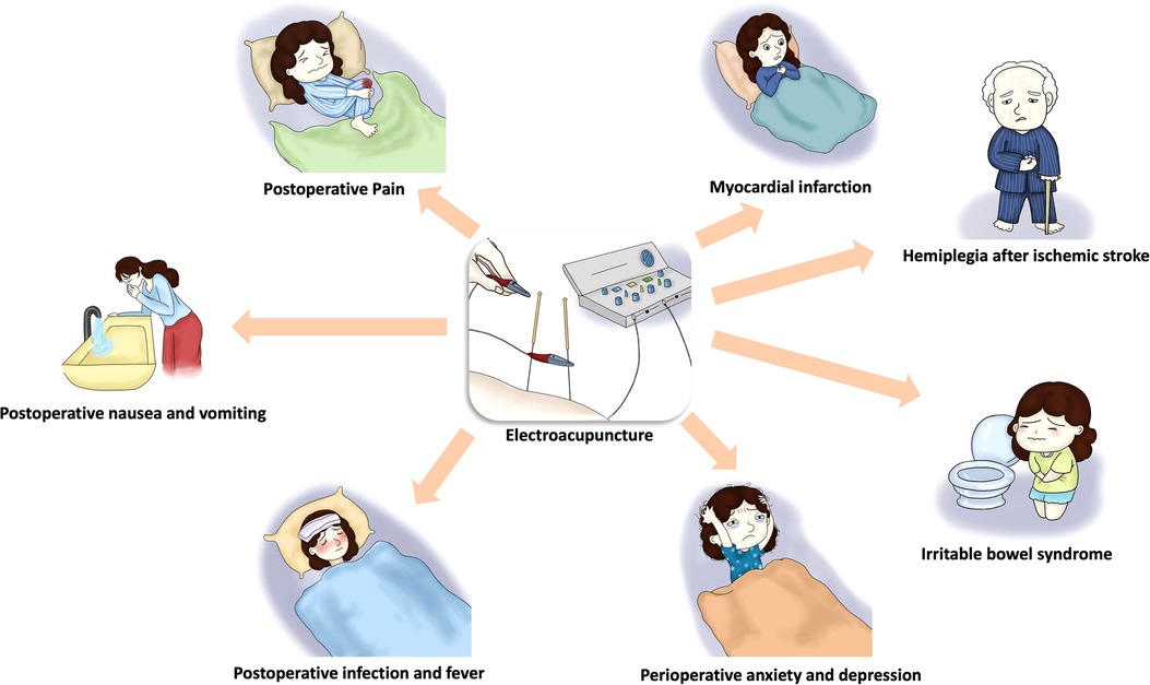 Perioperative Blood Pressure Control: Clinical Challenges (Slides