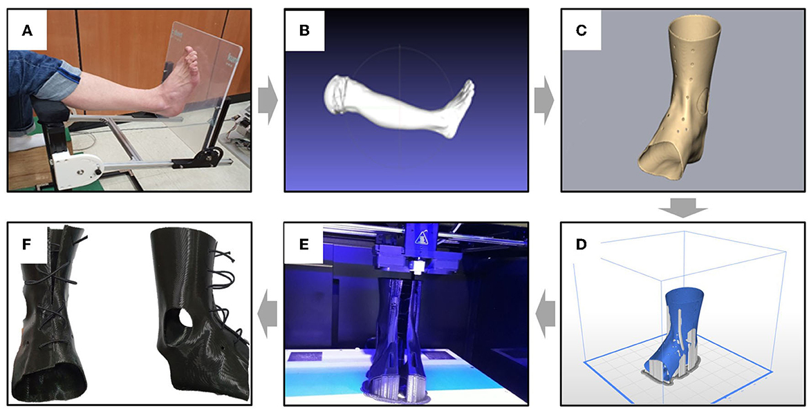 Six different states: a Rest, b Ankle plantar flexion, c Ankle