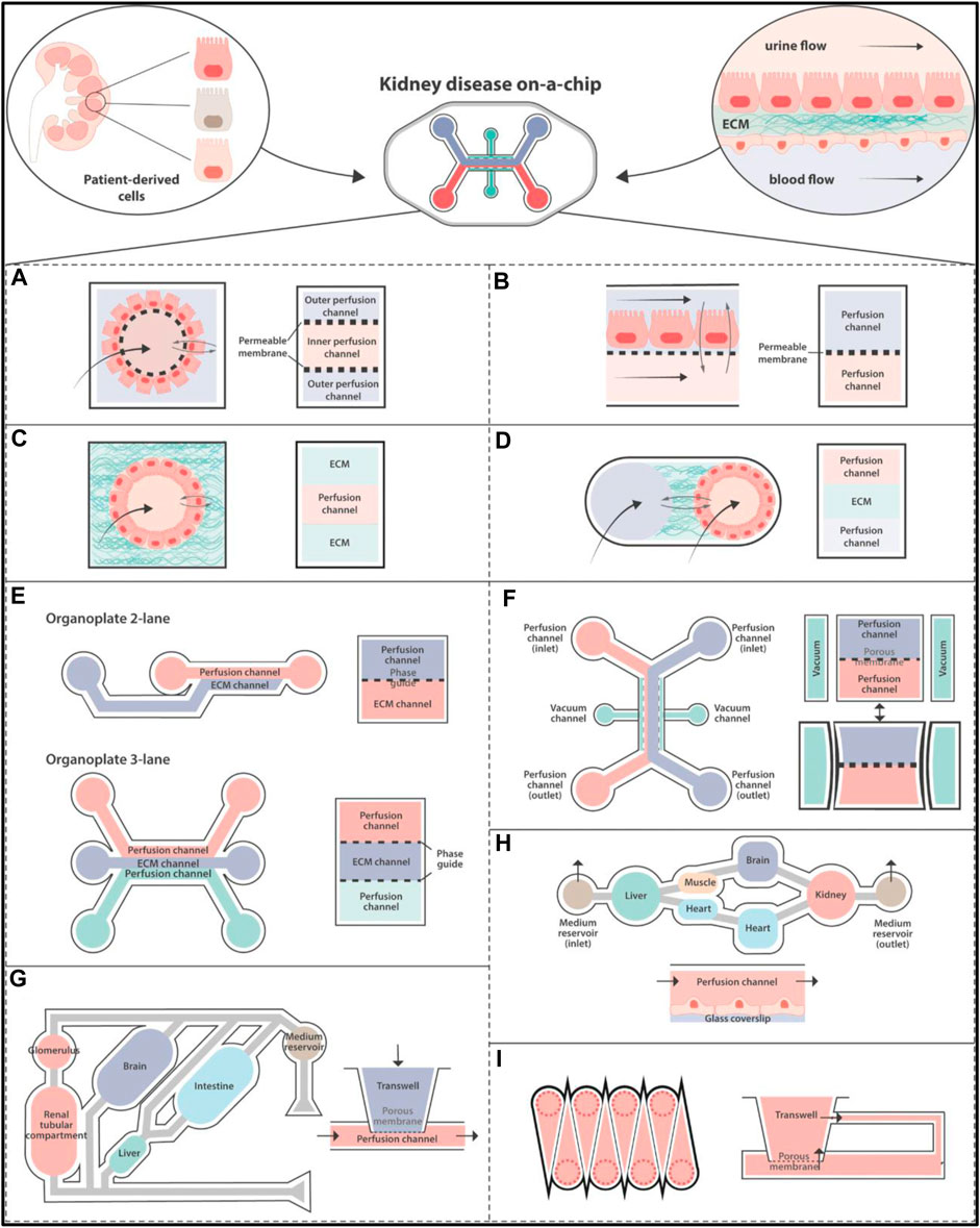 Frontiers  Revolutionizing drug development: harnessing the potential of  organ-on-chip technology for disease modeling and drug discovery