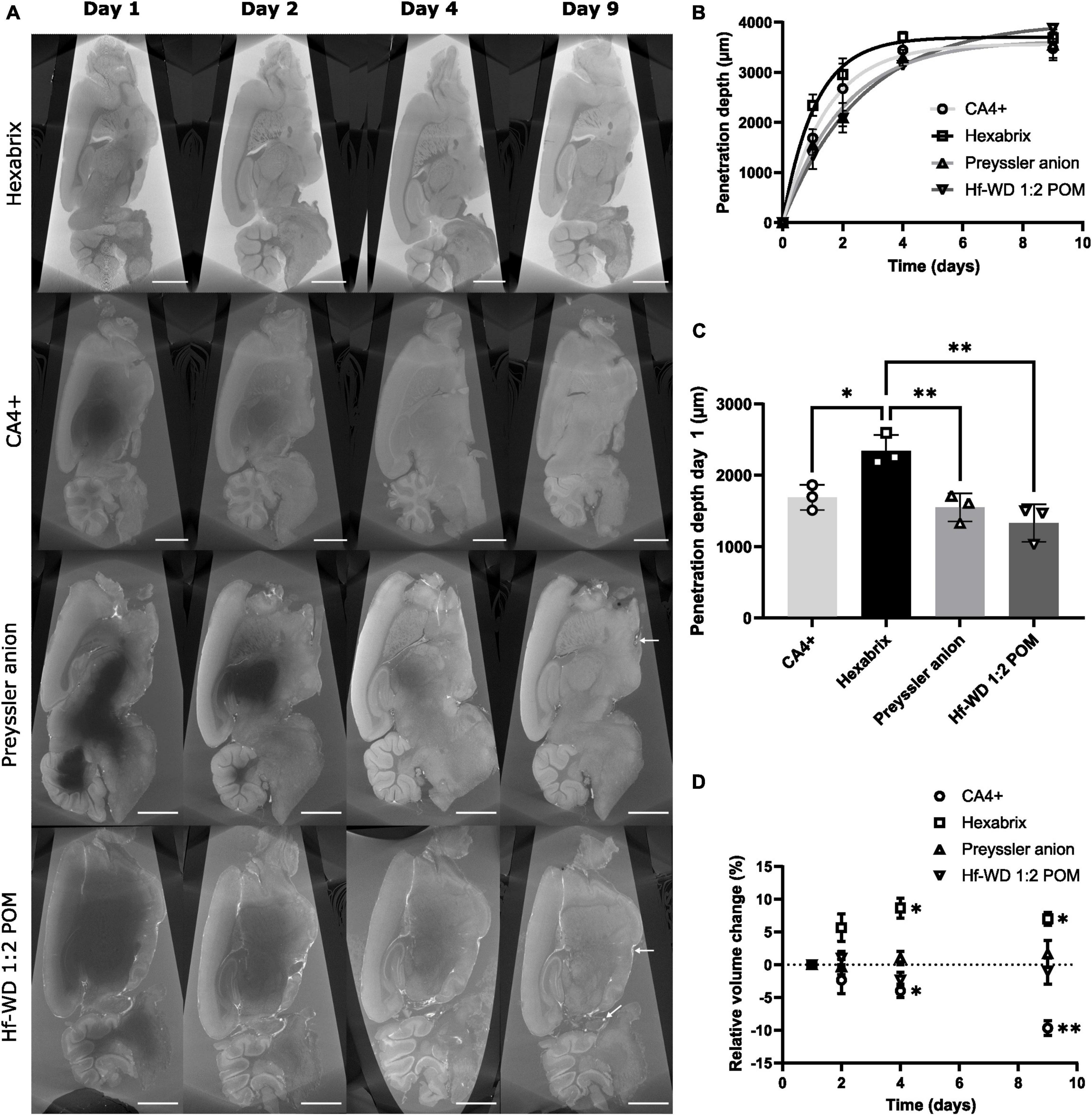 High-resolution micro-CT for 3D infarct characterization and segmentation  in mice stroke models