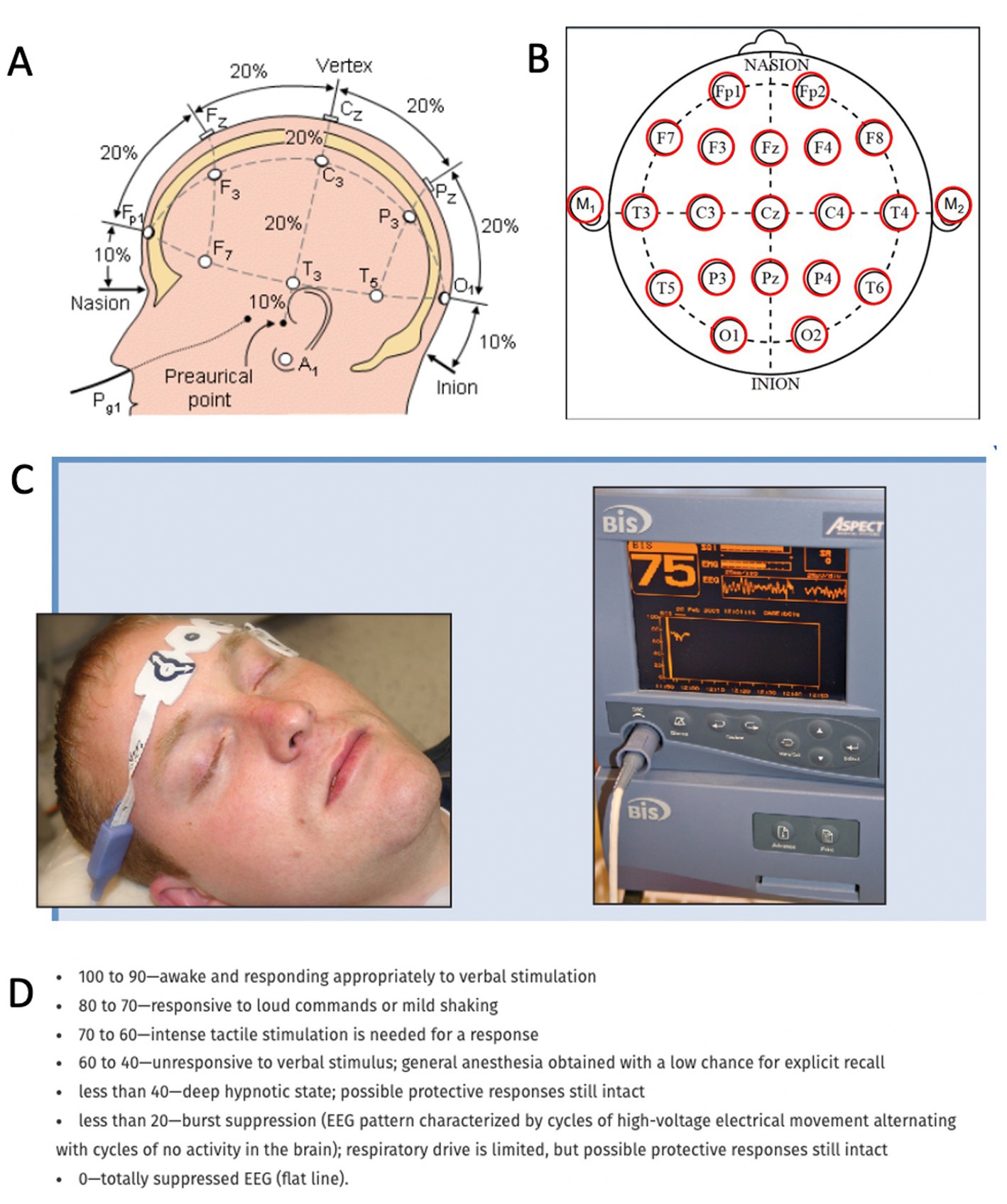 Frontiers | What happens in the brain when we die? Deciphering the ...