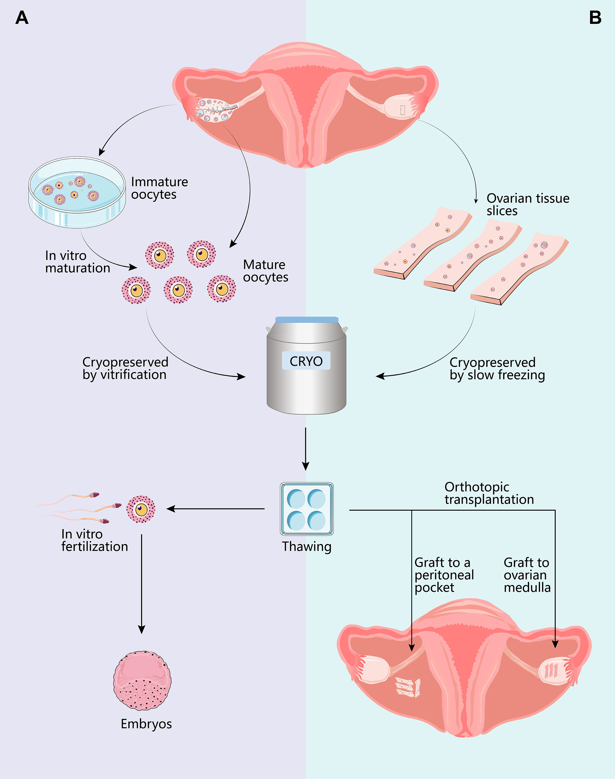 Frontiers Fertility preservation in pediatric healthcare a review