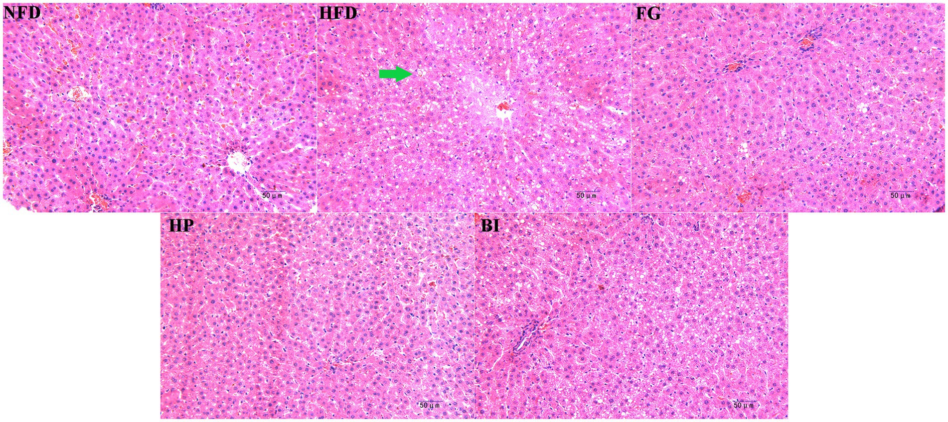 Frontiers | The lipid-lowering effects of fenugreek gum, hawthorn ...