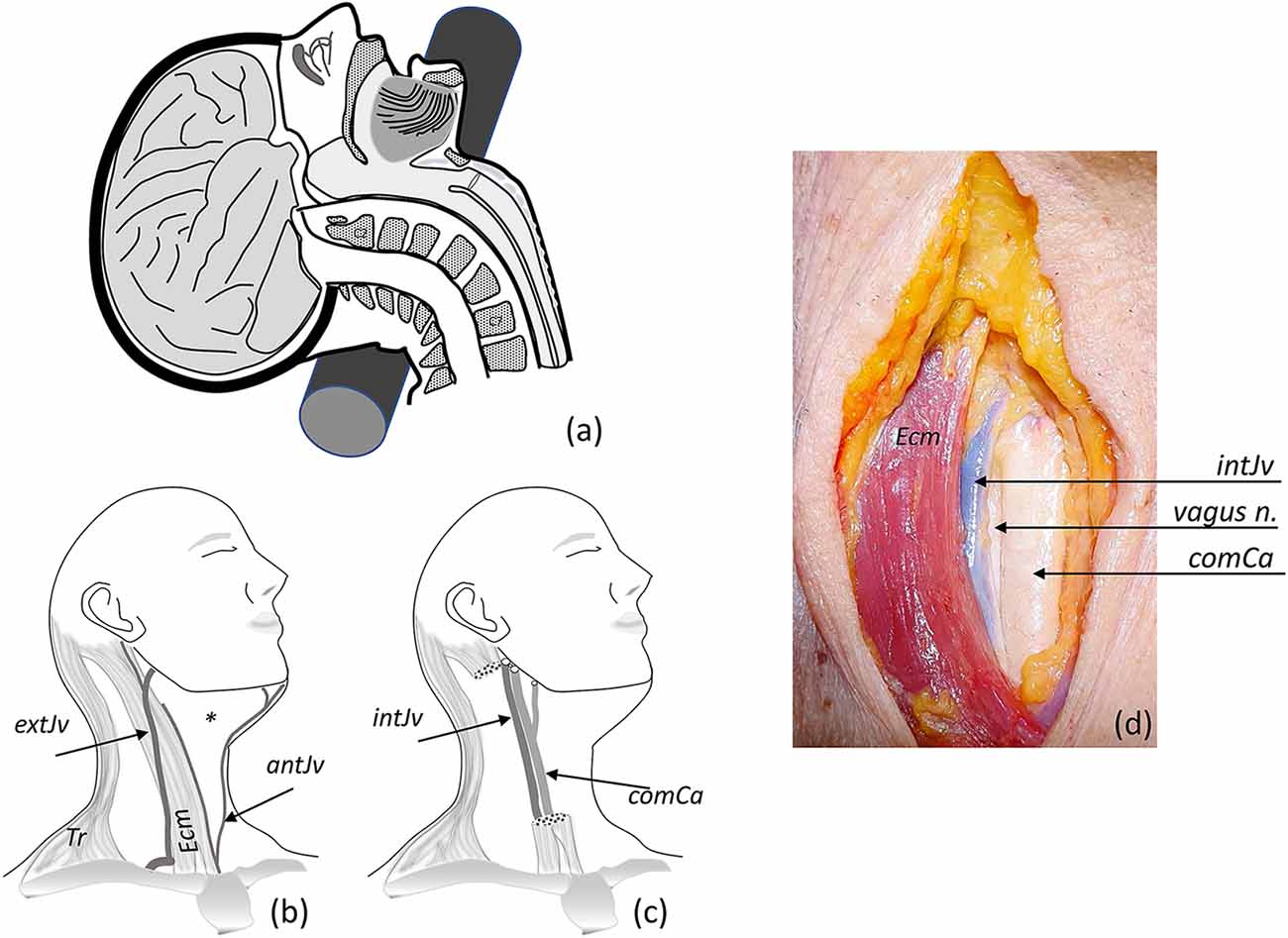 Frontiers  Ex vivo, in situ perfusion protocol for human brain fixation  compatible with microscopy, MRI techniques, and anatomical studies