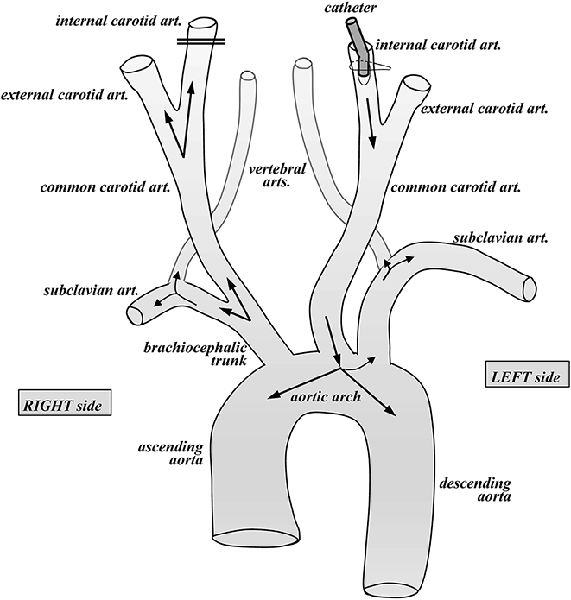 Frontiers  Ex vivo, in situ perfusion protocol for human brain fixation  compatible with microscopy, MRI techniques, and anatomical studies