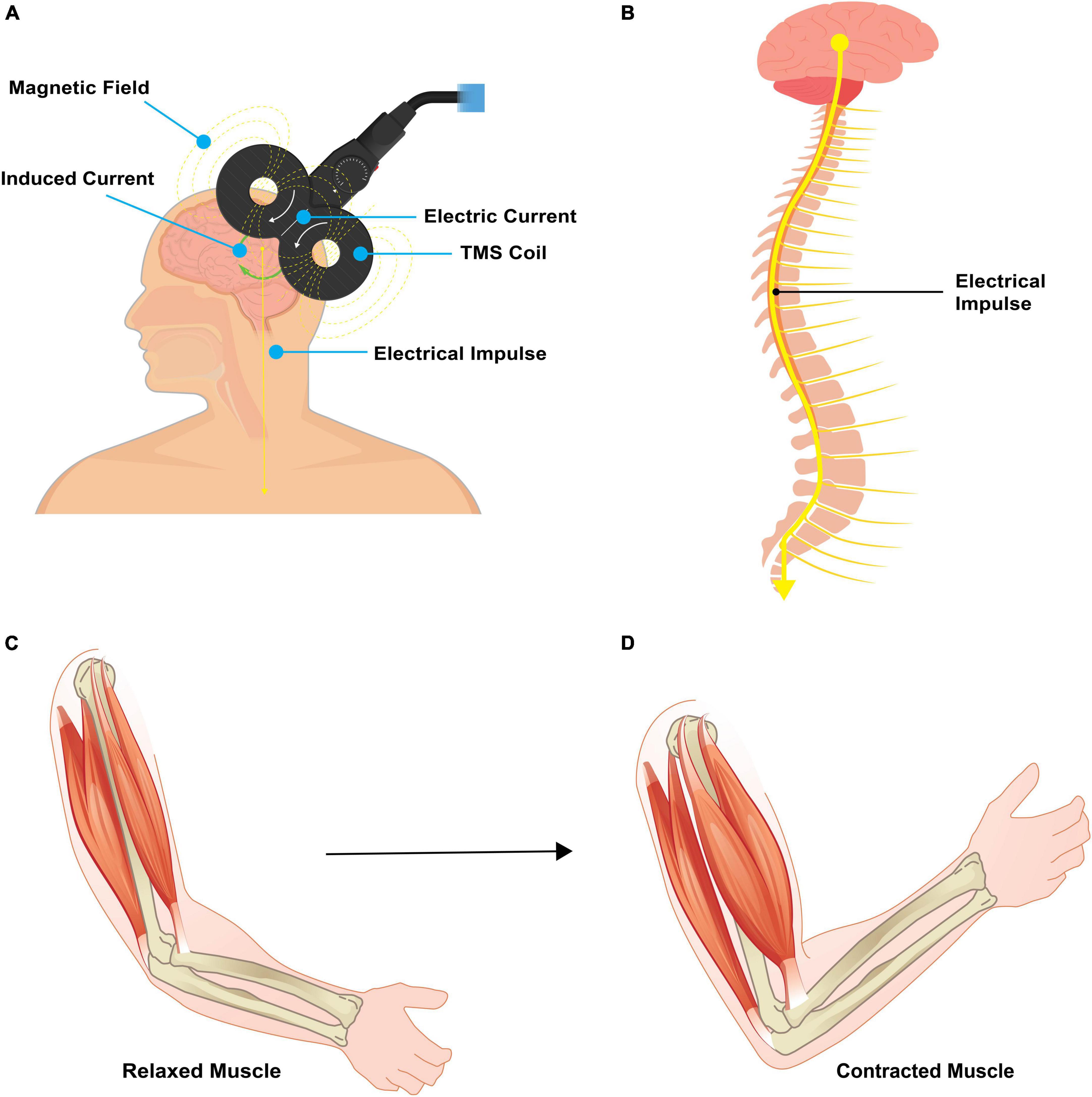 Neuromuscular electrical stimulation‐promoted plasticity of the human brain  - Carson - 2021 - The Journal of Physiology - Wiley Online Library