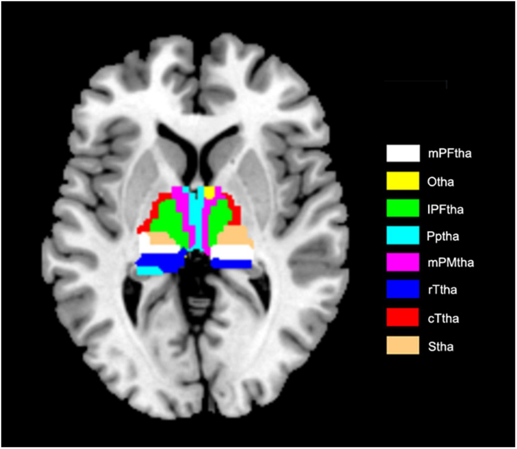 Frontiers  Neural activity in adults with major depressive disorder  differs from that in healthy individuals: A resting-state functional  magnetic resonance imaging study