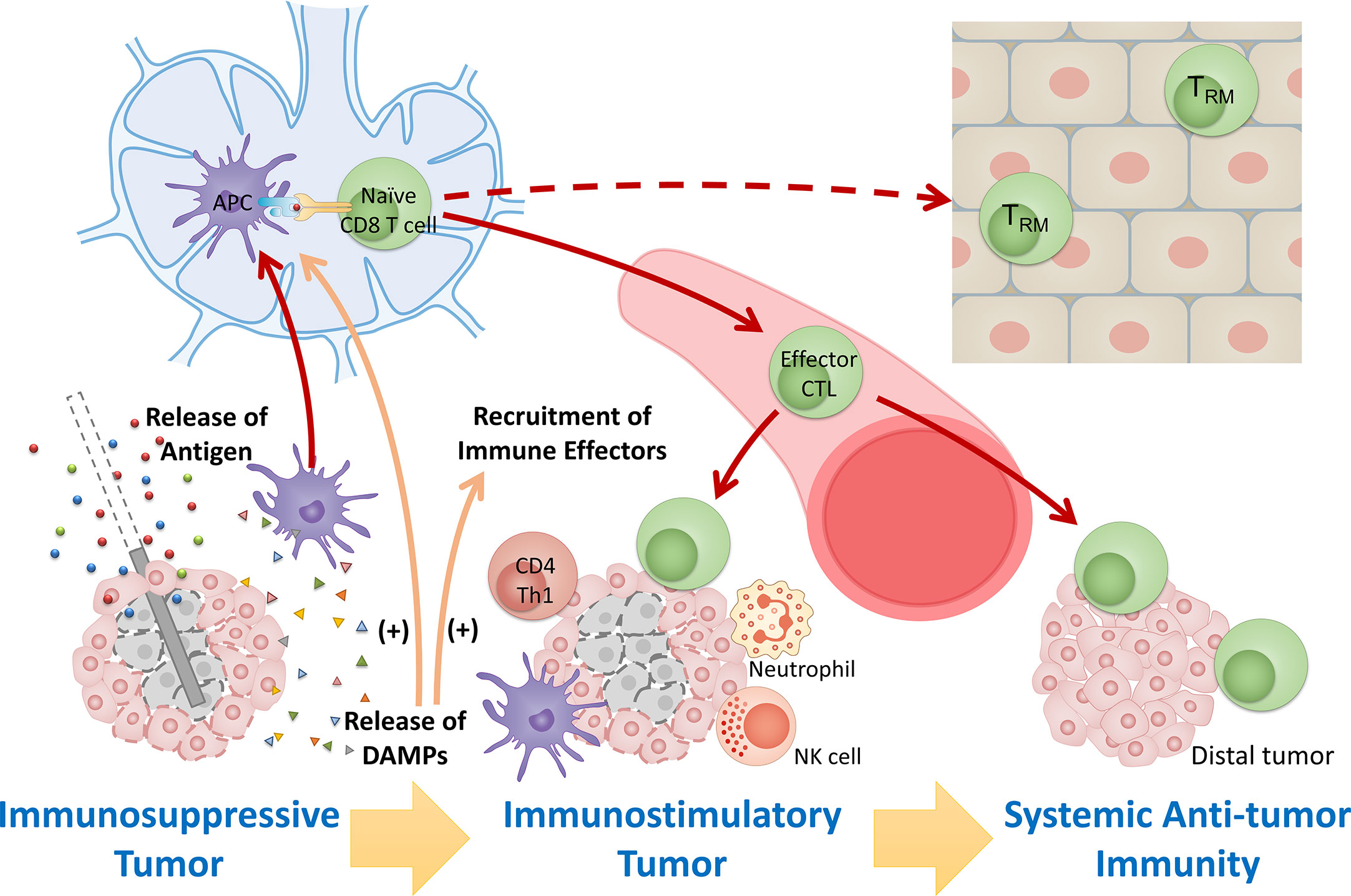 Frontiers | Combining energy-based focal ablation and immune