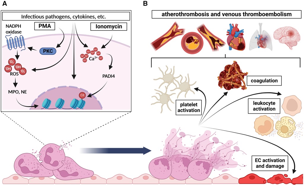 Frontiers | NET-(works) in arterial and venous thrombo-occlusive diseases