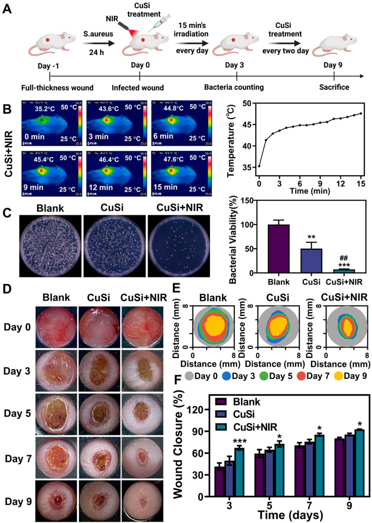 Frontiers  Mild-temperature photothermal assisted CuSi nanowires for  promoting infected wound healing