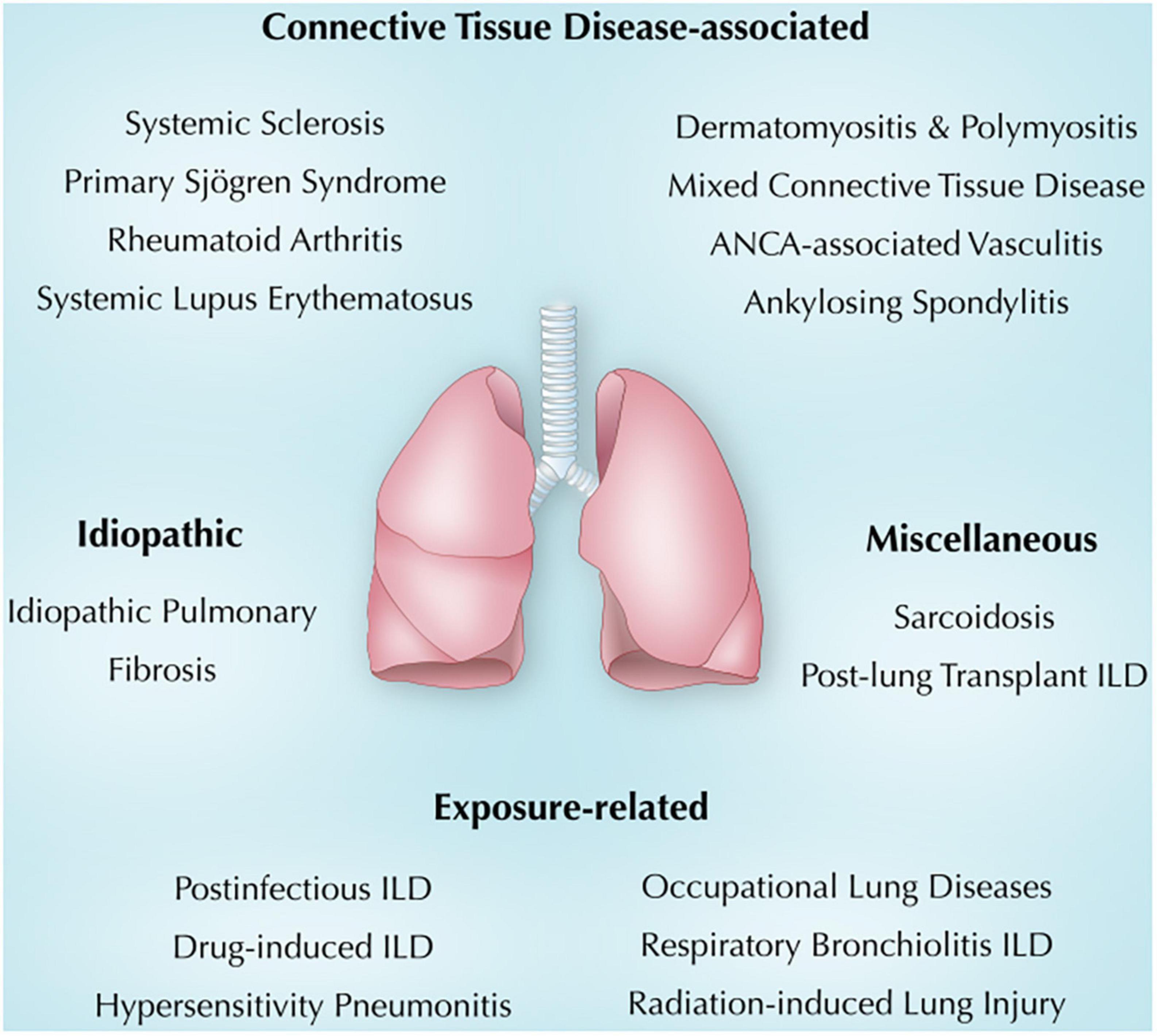 Frontiers Immune-mediated lung diseases A narrative review