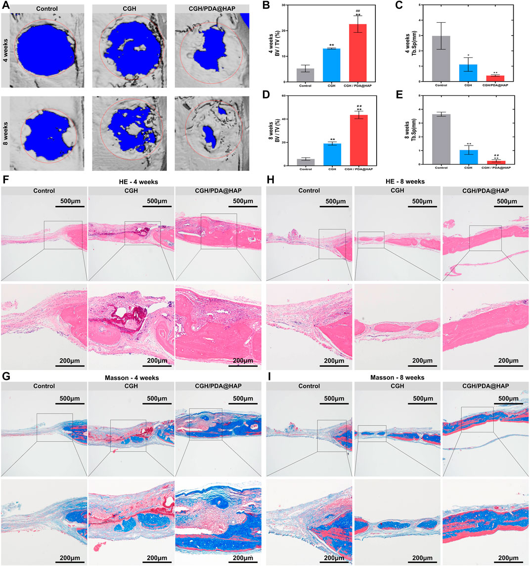 PVA/Poly(hexamethylene guanidine)/Gallic Acid Composite Hydrogel Films and  Their Antibacterial Performance