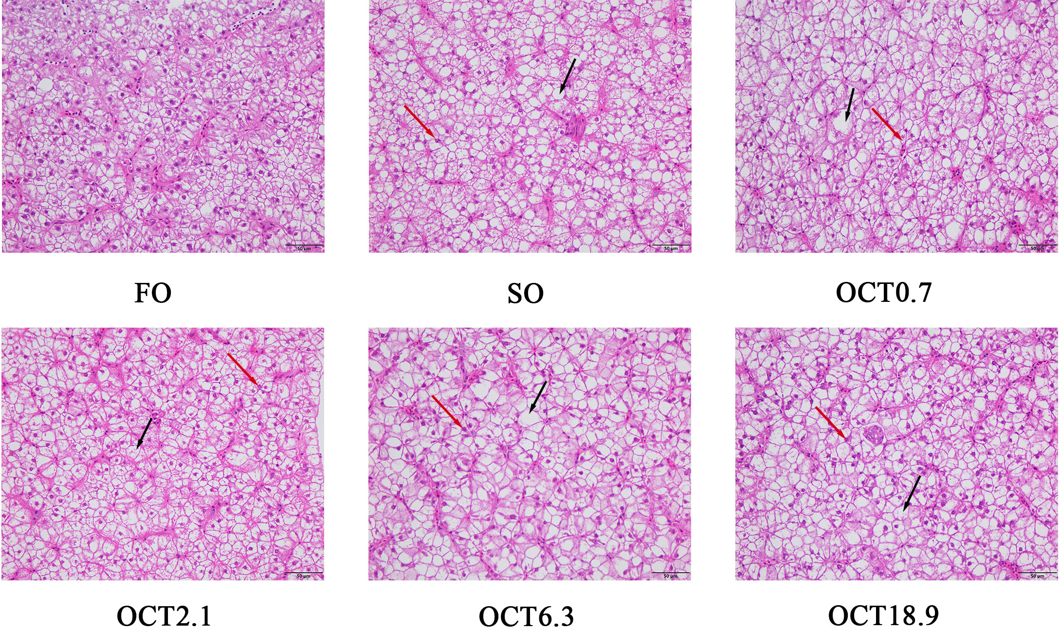 Impact on the antioxidant system, histology, and cell death of