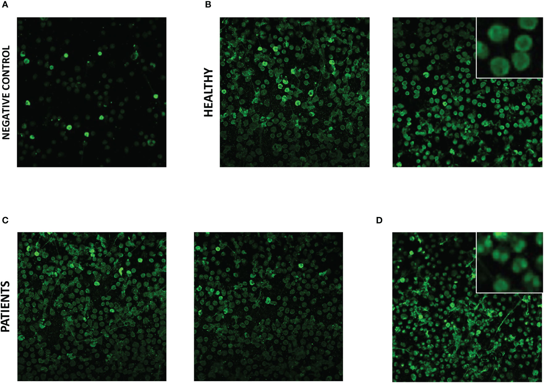 Frontiers | Identification of autoantigens and their potential post ...