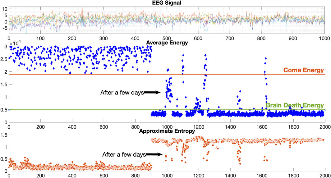 Frontiers | EEG-based real-time diagnostic system with developed ...