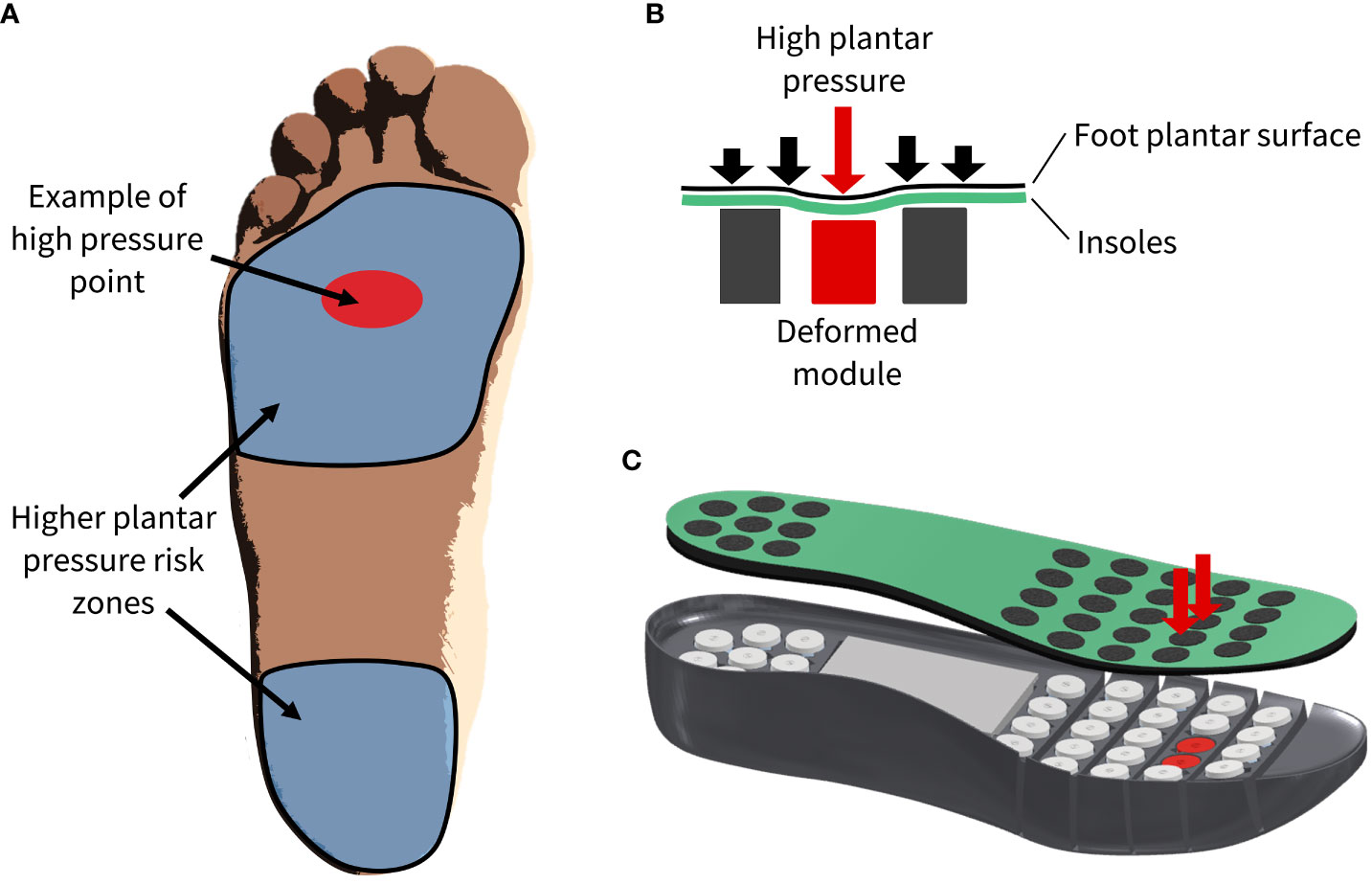 Frontiers | Intelligent plantar pressure offloading for the prevention ...