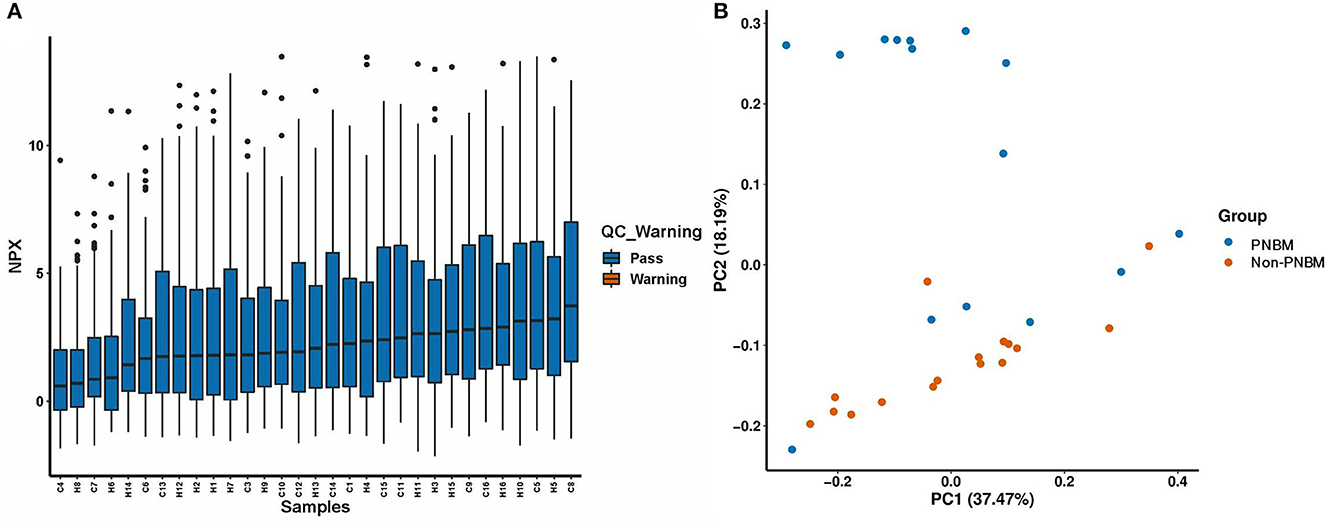 PDF) Cerebrospinal fluid lactate level as a diagnostic biomarker for bacterial meningitis in children