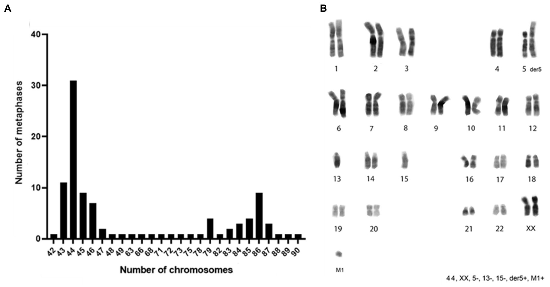 Frontiers  Characteristics of Whale Müller Glia in Primary and  Immortalized Cultures