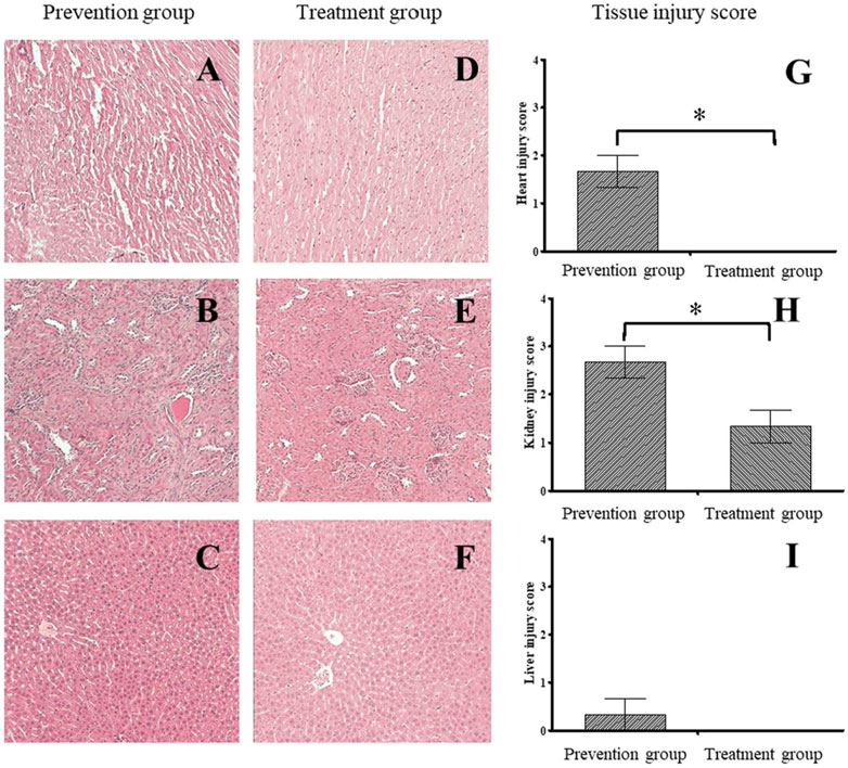 of treatment and storage time on the color values of MF and VF