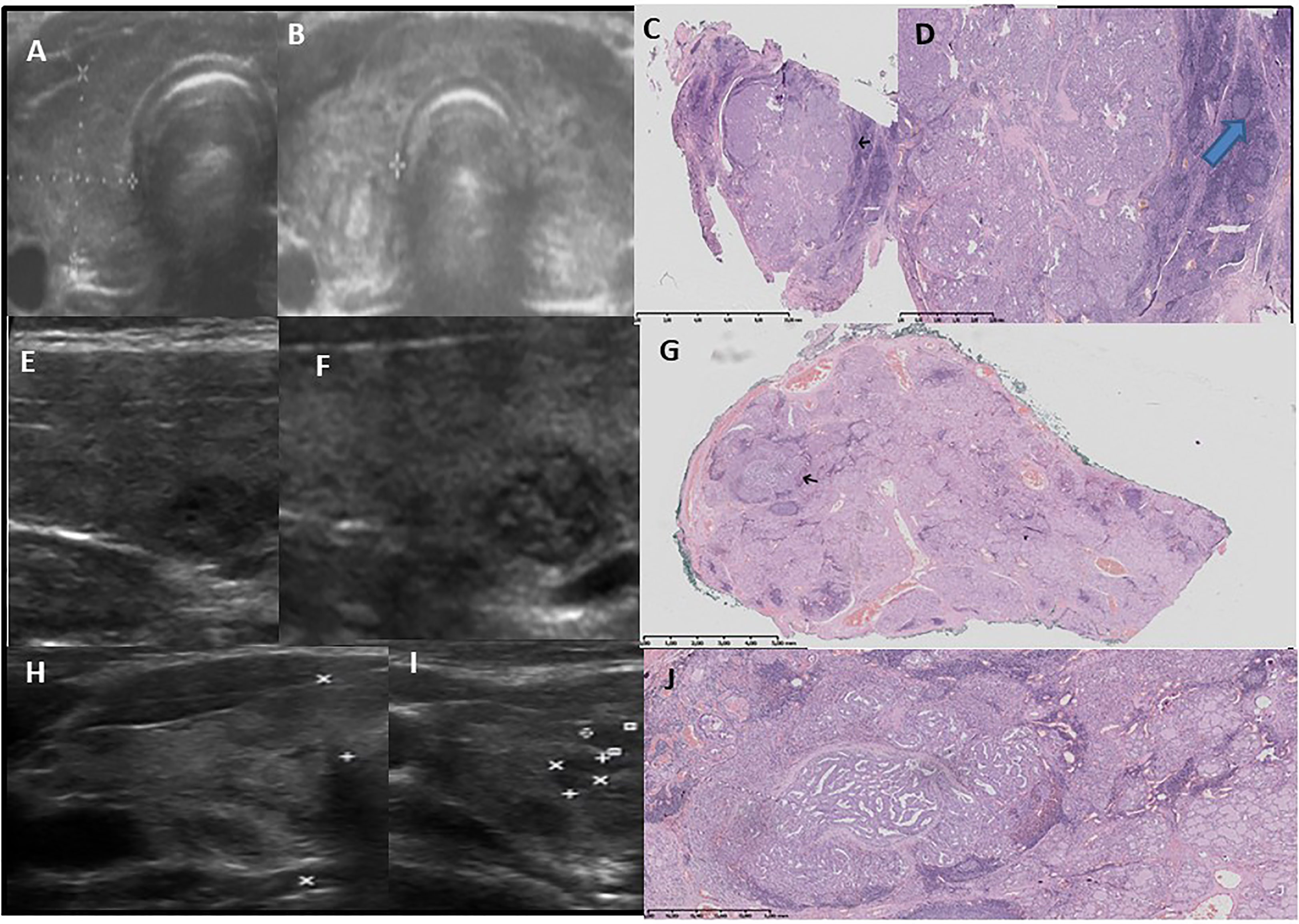 A-D Four representative cases of different breast size and parenchymal