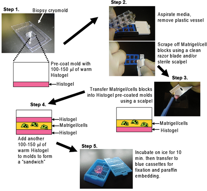 liver metastasis basic aspects detection and management 1984