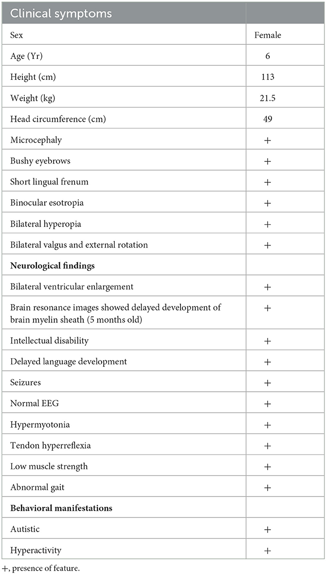 Cureus, Whole-Exome Sequencing Identified a Novel DYRK1A Variant in a  Patient With Intellectual Developmental Disorder, Autosomal Dominant 7