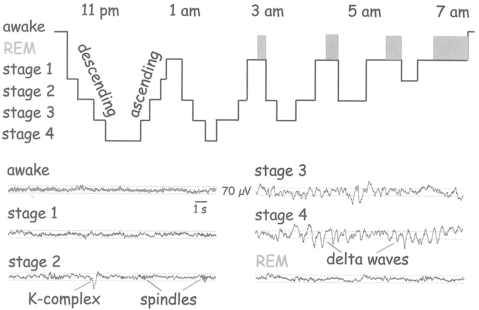 Frontiers | Why Does Rem Sleep Occur? A Wake-Up Hypothesis1 | Frontiers ...