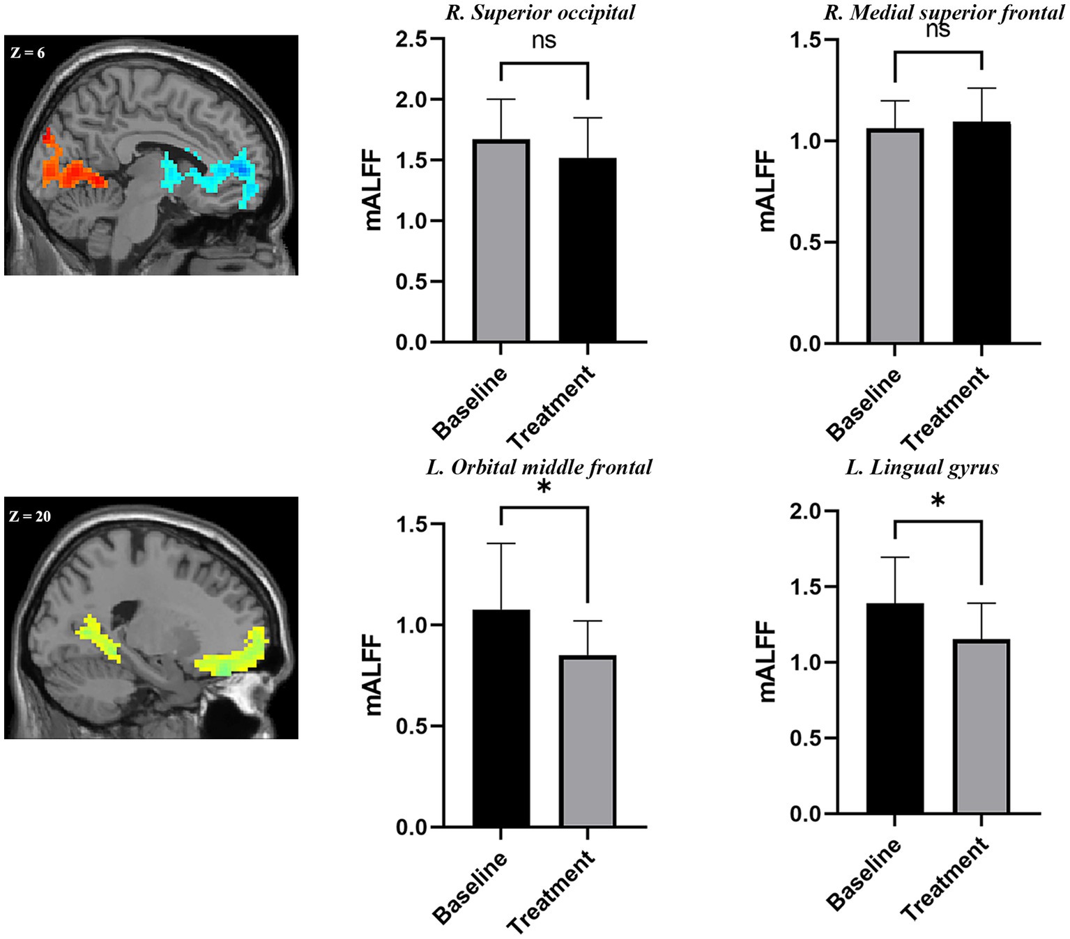 Frontiers  Abnormal brain spontaneous activity in major depressive  disorder adolescents with non-suicidal self injury and its changes after  sertraline therapy