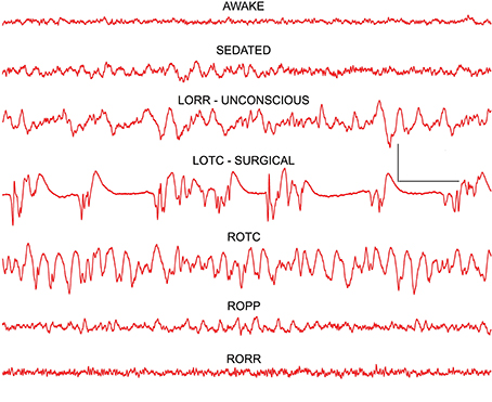 eeg test side effects eeg test side effects