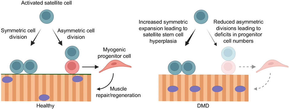 Frontiers Myogenic Cell Transplantation in Genetic and Acquired