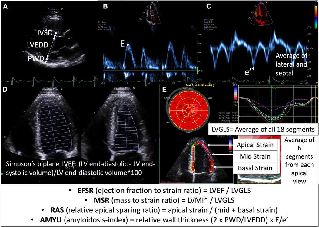 Efficacy of echocardiography for differential diagnosis of left ventricular  hypertrophy: special focus on speckle-tracking longitudinal strain