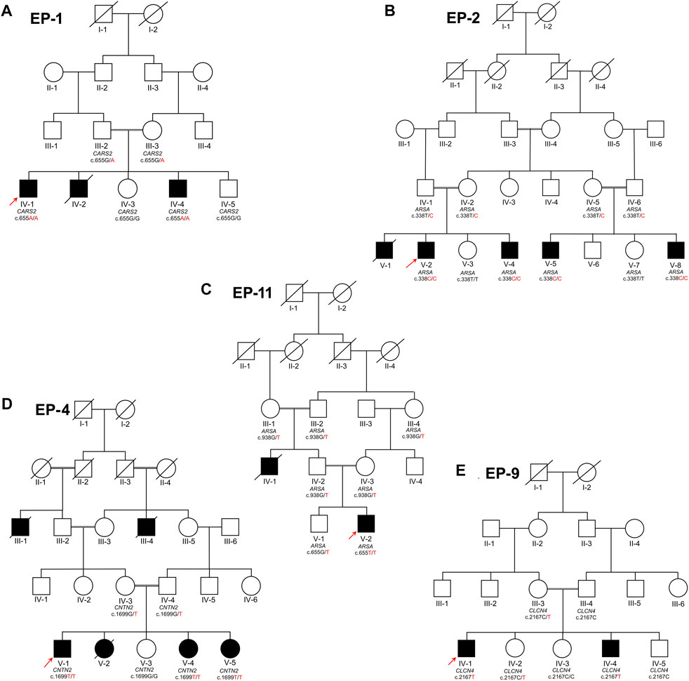 Cureus, Whole-Exome Sequencing Identified a Novel DYRK1A Variant in a  Patient With Intellectual Developmental Disorder, Autosomal Dominant 7