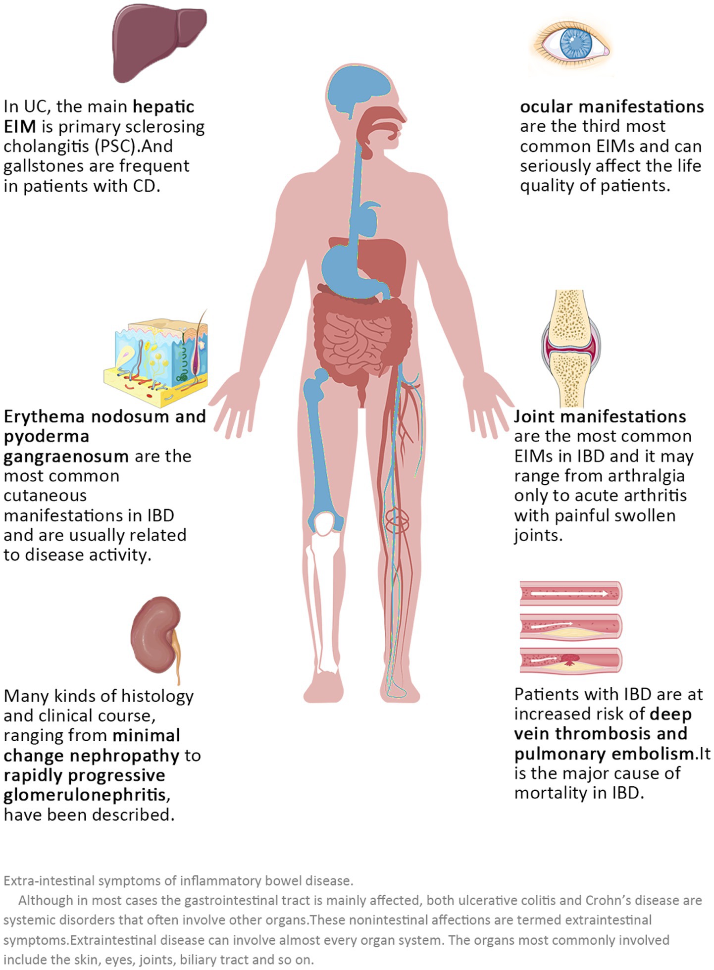 PDF] Epidemiology and Outcomes of Acute Flank Pain in University-Affiliated  Regional Emergency Medical Centers