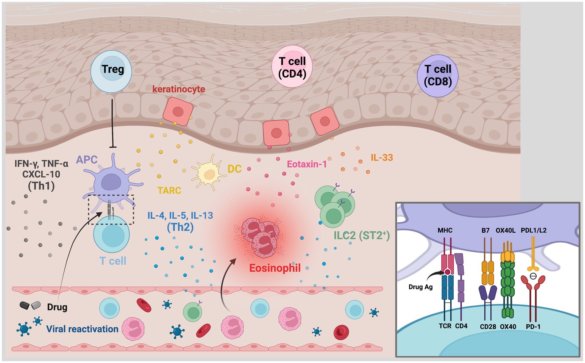 Síndrome de DRESS (Drug Reaction with Eosinophilia and Systemic Symptoms)  por Sulfassalazina em paciente em tratamento para Doença Inflamatória  Intestinal