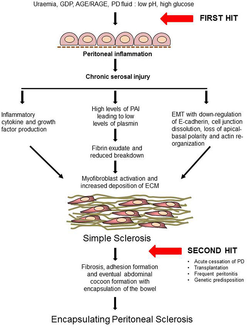 mesothelioma pbs