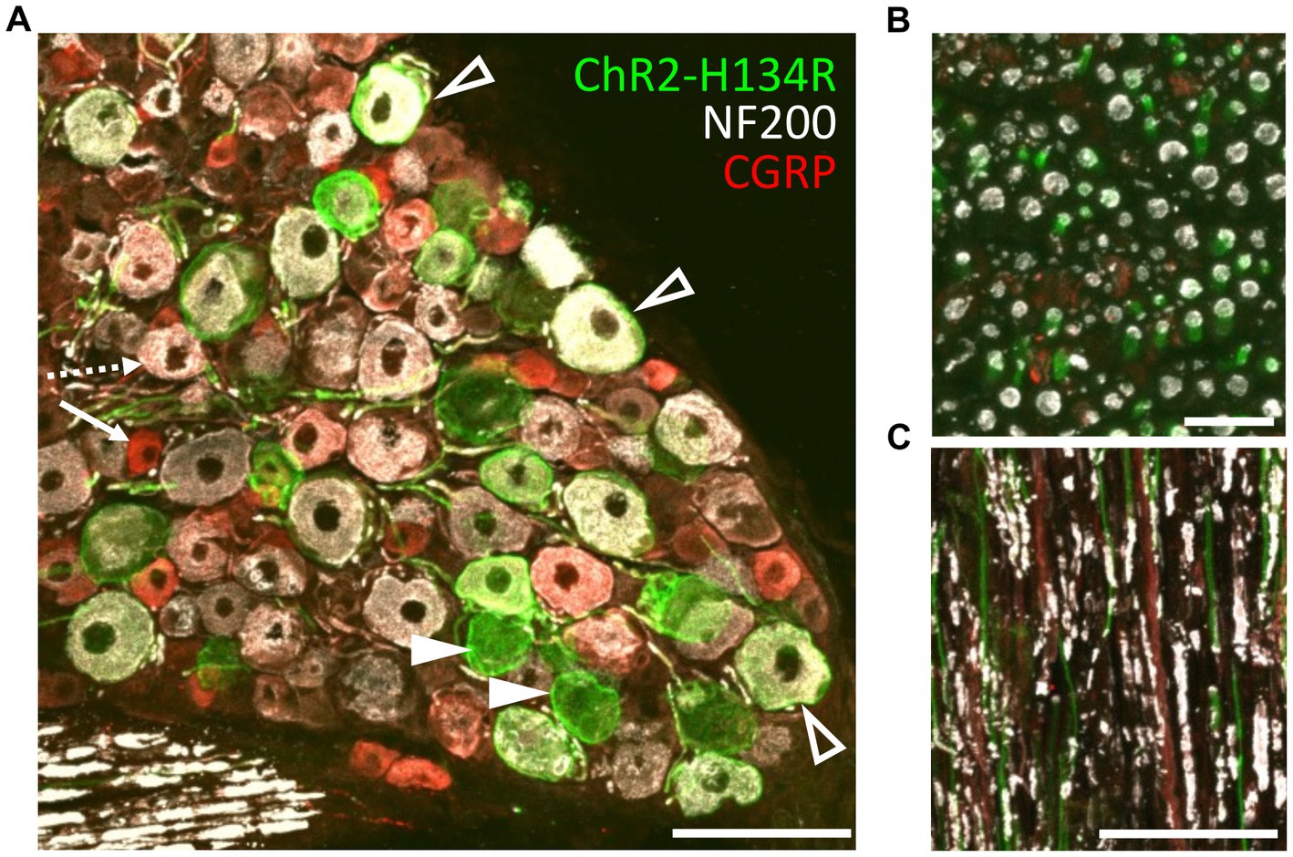 Frontiers  Combined optogenetic and electrical stimulation of the sciatic  nerve for selective control of sensory fibers