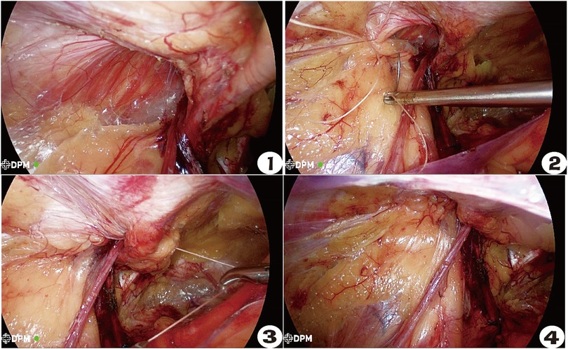 The Truth About Hernia Mesh, Department of Surgery