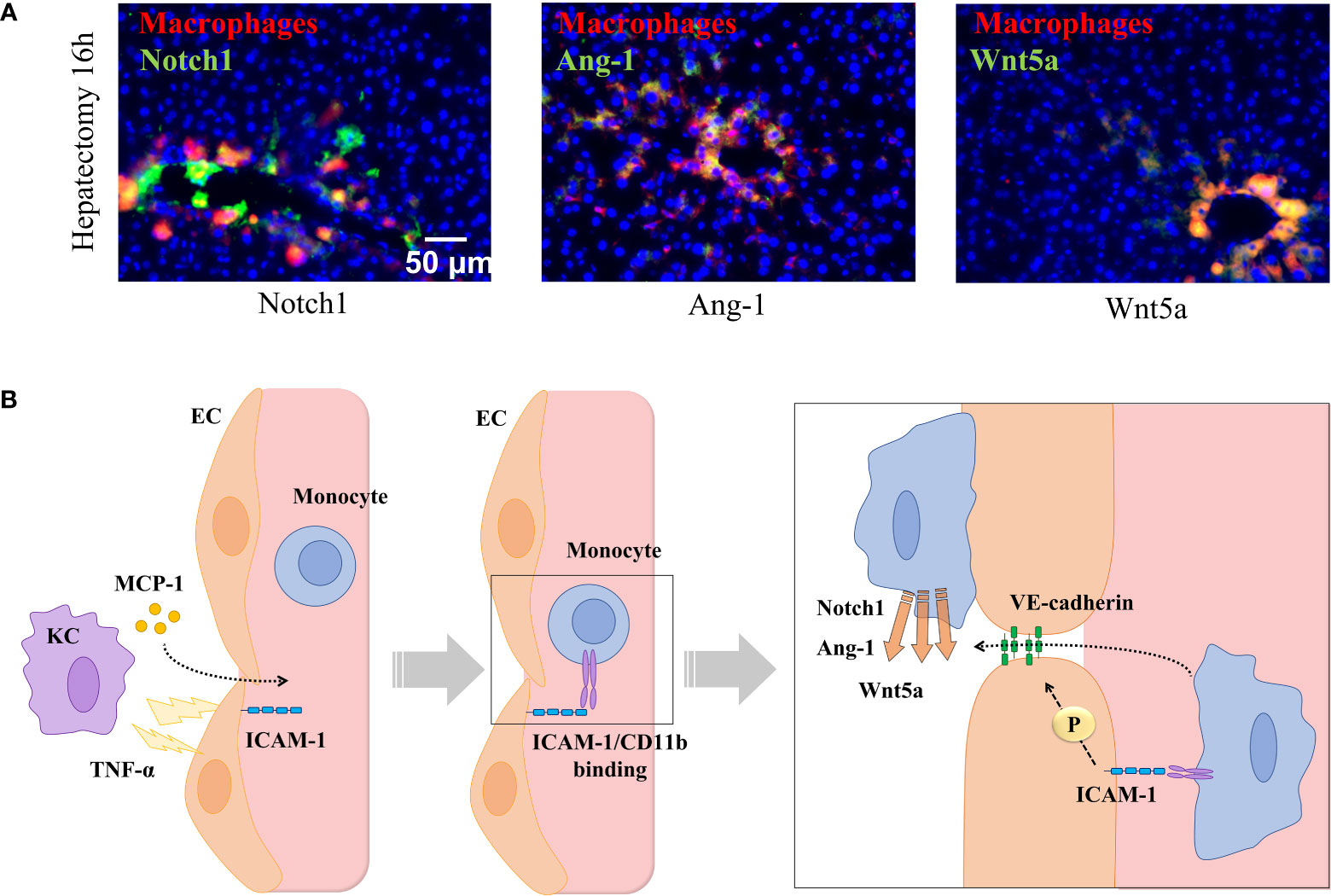 Suppressive Role of Endogenous Endothelial Monocyte Chemoattractant  Protein–1 on Monocyte Transendothelial Migration In Vitro