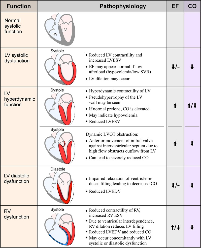 Frontiers  Sepsis-Induced myocardial dysfunction: heterogeneity of  functional effects and clinical significance