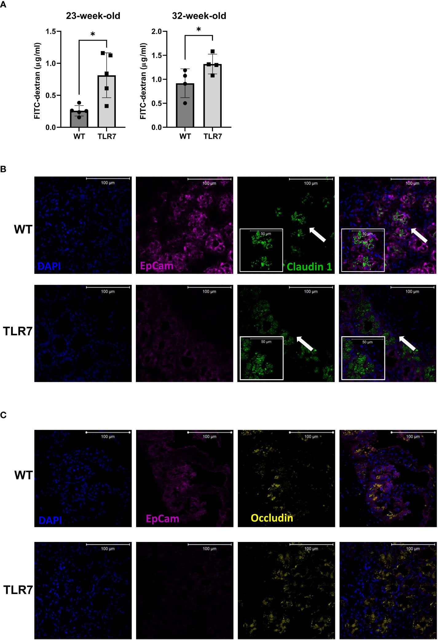 The systemic anti-microbiota IgG repertoire can identify gut