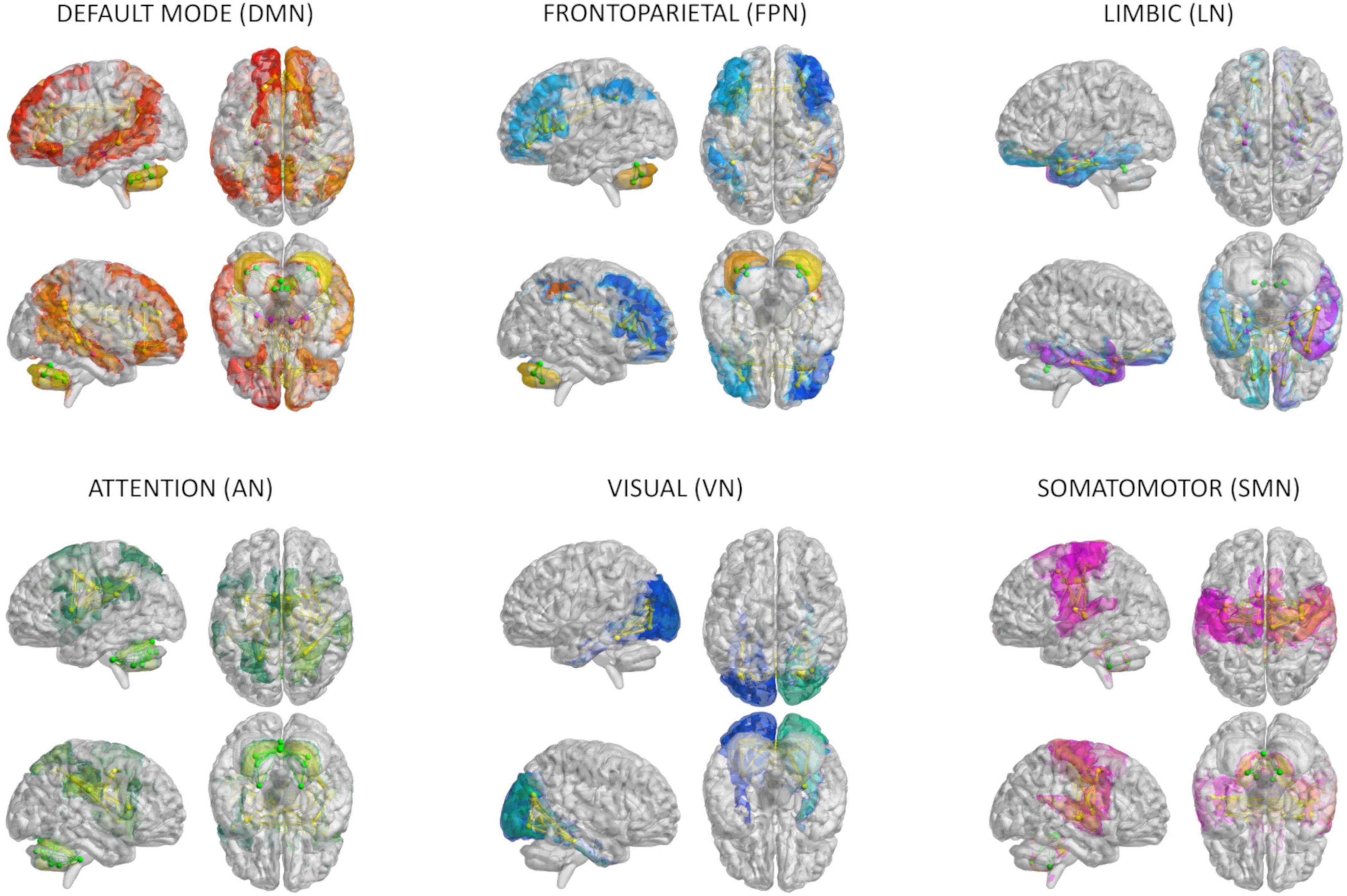 Frontiers | Virtual brain simulations reveal network-specific parameters in  neurodegenerative dementias