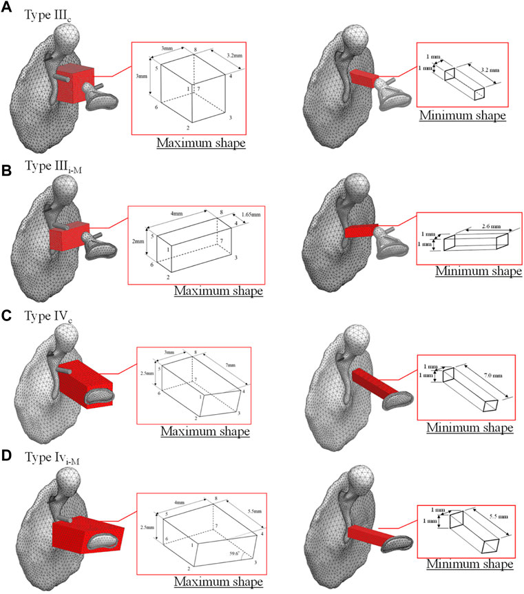 Frontiers | Mechanical effect of reconstructed shapes of autologous ...