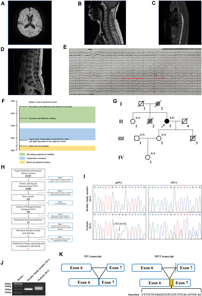 PDF) The Arp1/11 minifilament of dynactin primes the endosomal