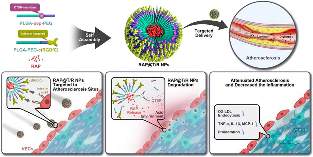 Frontiers  Characteristics and evaluation of atherosclerotic plaques: an  overview of state-of-the-art techniques